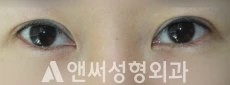 Answer Plastic Surgery case 254: Before