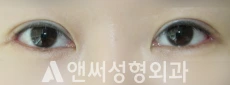 Answer Plastic Surgery case 254: After