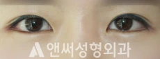 Answer Plastic Surgery case 253: After