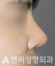 Answer Plastic Surgery case 252: After
