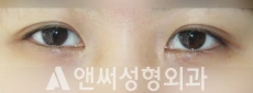 Answer Plastic Surgery case 242: Before