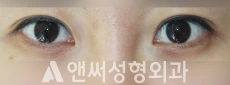 Answer Plastic Surgery case 250: Before
