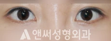 Answer Plastic Surgery case 250: After