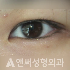 Answer Plastic Surgery case 249: Before