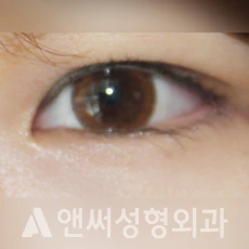 Answer Plastic Surgery case 249: After