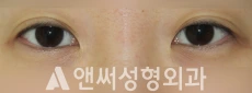 Answer Plastic Surgery case 248: Before