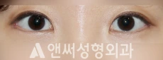 Answer Plastic Surgery case 248: After