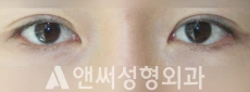 Answer Plastic Surgery case 247: Before