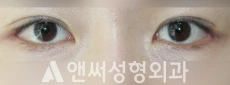 Answer Plastic Surgery case 247: After
