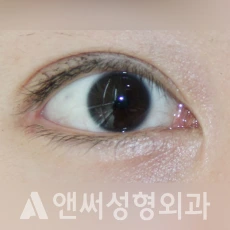 Answer Plastic Surgery case 246: After
