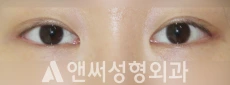 Answer Plastic Surgery case 245: After