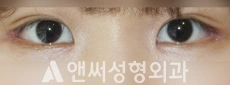 Answer Plastic Surgery case 244: After
