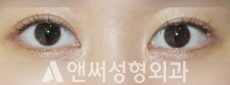 Answer Plastic Surgery case 243: After