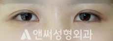Answer Plastic Surgery case 242: After