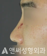 Answer Plastic Surgery case 241: Before