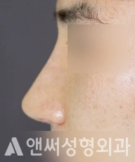 Answer Plastic Surgery case 241: After