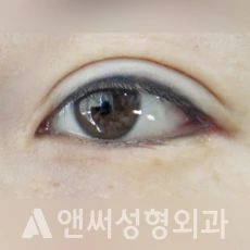Answer Plastic Surgery case 240: After