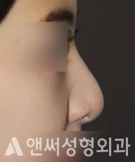 Answer Plastic Surgery case 239: Before