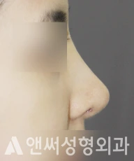 Answer Plastic Surgery case 239: After