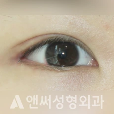 Answer Plastic Surgery case 238: After