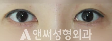 Answer Plastic Surgery case 237: Before