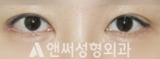 Answer Plastic Surgery case 237: After