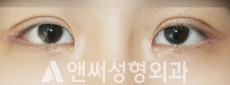 Answer Plastic Surgery case 236: After