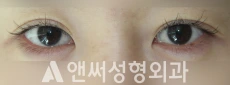 Answer Plastic Surgery case 235: Before