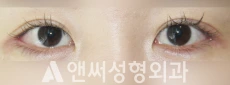 Answer Plastic Surgery case 235: After