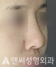 Answer Plastic Surgery case 234: Before