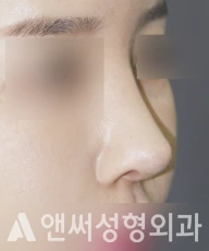 Answer Plastic Surgery case 234: After