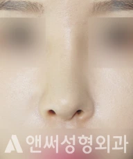 Answer Plastic Surgery case 233: After