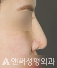 Answer Plastic Surgery case 232: Before