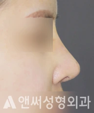 Answer Plastic Surgery case 232: After