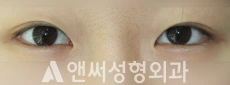 Answer Plastic Surgery case 231: Before