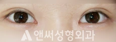 Answer Plastic Surgery case 231: After