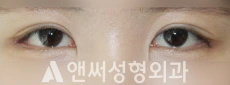 Answer Plastic Surgery case 230: After