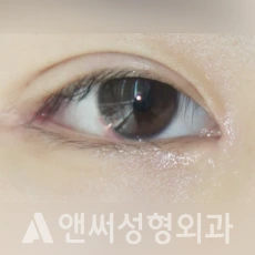 Answer Plastic Surgery case 229: After