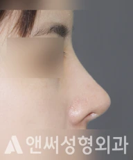 Answer Plastic Surgery case 228: After