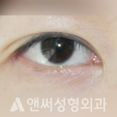 Answer Plastic Surgery case 227: After