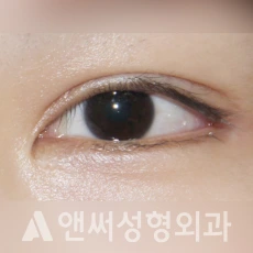 Answer Plastic Surgery case 226: After