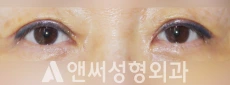 Answer Plastic Surgery case 225: After