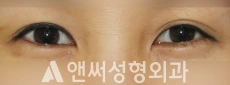 Answer Plastic Surgery case 224: Before