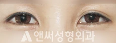 Answer Plastic Surgery case 224: After