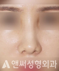 Answer Plastic Surgery case 223: After