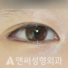 Answer Plastic Surgery case 221: After