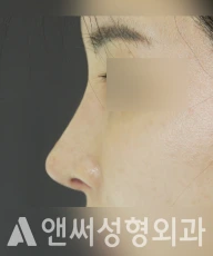 Answer Plastic Surgery case 220: After