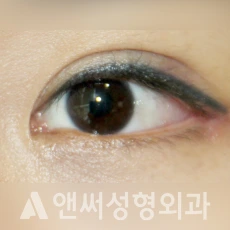 Answer Plastic Surgery case 219: After
