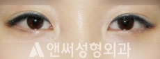 Answer Plastic Surgery case 218: After