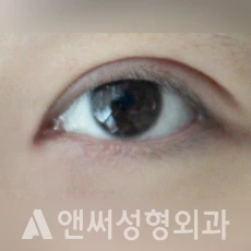 Answer Plastic Surgery case 217: After